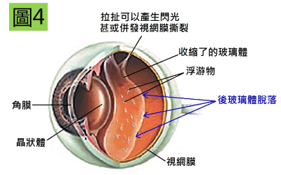 深圳眼科医院-深圳希玛林顺潮眼科