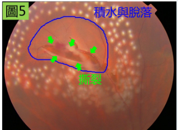 深圳眼科医院-深圳希玛林顺潮眼科