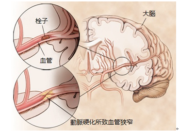 深圳眼科医院-深圳希玛林顺潮眼科医院